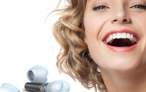 Ce trebuie sa stii despre costurile unui implant dentar?