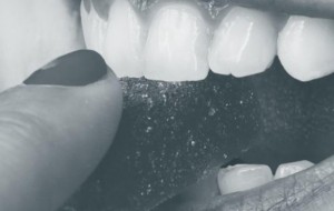 Cum te poate ajuta un aparat dentar sa  ai un zambet mult mai frumos?